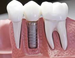 Możliwości współczesnej stomatologii